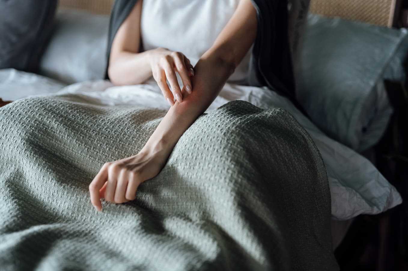 Kvinna kliar röd ringformad utslag på underarmen – symtom på ringorm, en vanlig svampinfektion i huden som kan behandlas online via Doktera.se